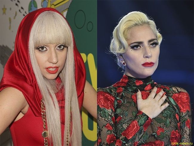 Пользователи Twitter уверены, что Леди Гага — жертва пластики