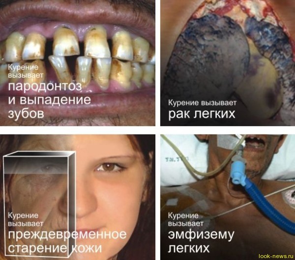 Эти изображения были утверждены Советом по здравоохранению стран ЕврАзЭС и одобрены экспертным советом при Минздравсоцразвития России